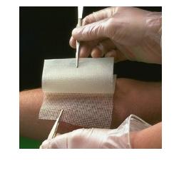 GARZA MEDICATA BACTIGRAS CON CLOREXIDINA ACETATO 0,5% 15X20CM 10 PEZZI - Farmaciacarpediem.it